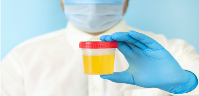 Urine Analysis